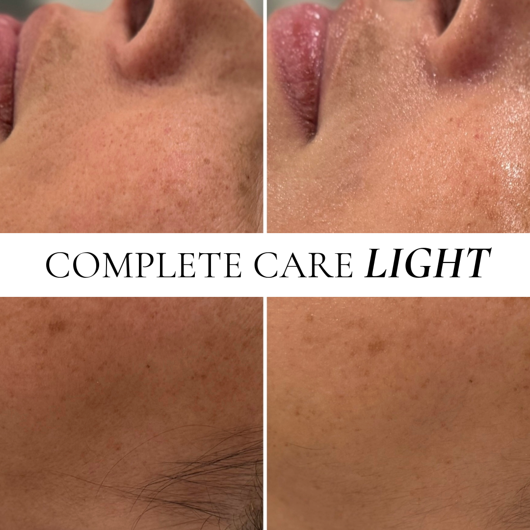 COMPLETE CARE LIGHT(First Visit 40% Off)
