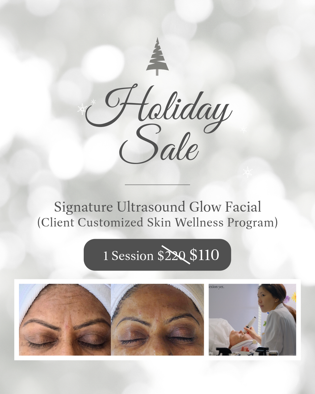 Holiday Promotion Signature Ultrasound Glow Facial 1 Session